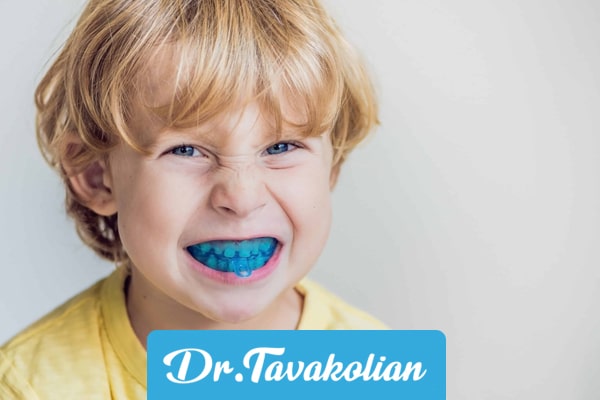برای دندان قروچه کودکان به چه پزشکی مراجعه کنیم