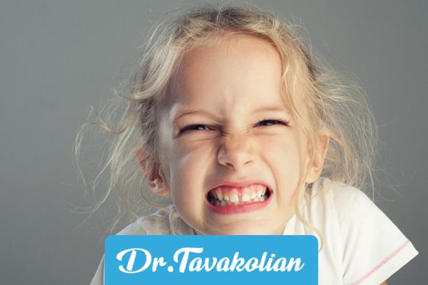 برای دندان قروچه کودکان به چه پزشکی مراجعه کنیم
