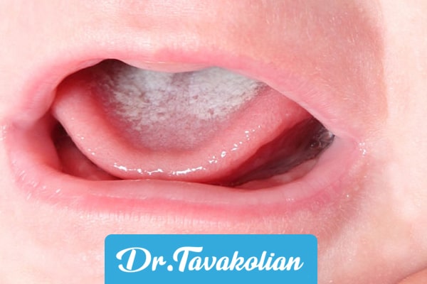 علت تلخی دهان چیست؟آیا تلخی دهان خطرناک است