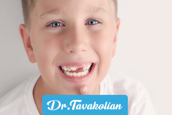 معرفی انواع دندان های کودکان + کاربرد و نکات مهم آن ها