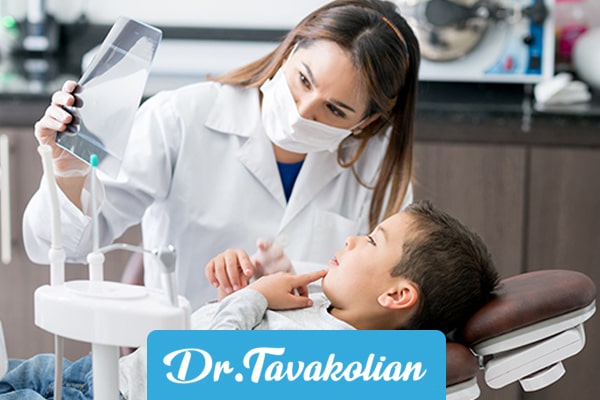 انواع عصب کشی دندان کودکان