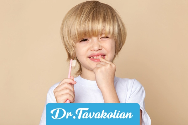 روند پوسیدگی دندان های شیری