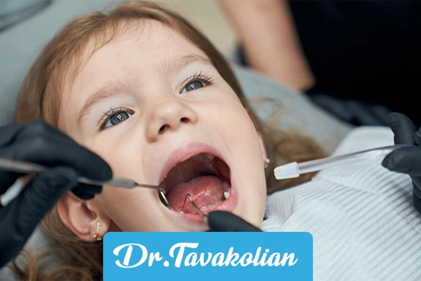 روکش دندان کودکان چیست ؟