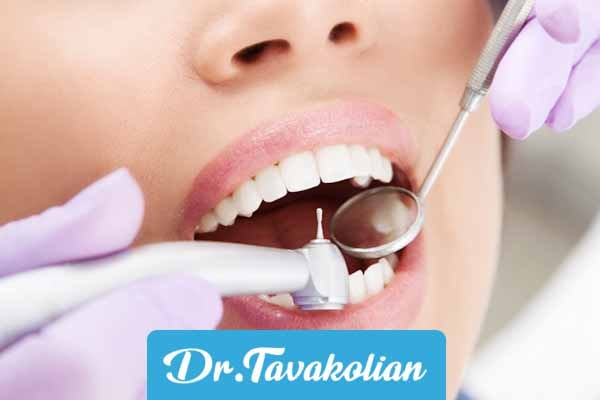 پر کردن و ترمیم دندان کودکان