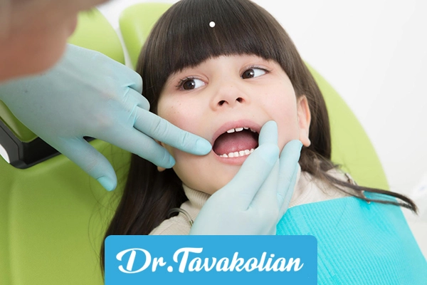 عصب کشی دندان کوکان با بیوشی