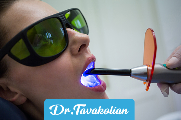 درمان فلوراید تراپی