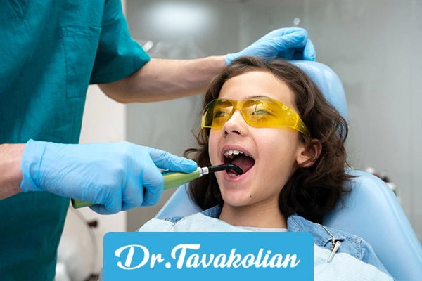 فلوراید تراپی کودکان