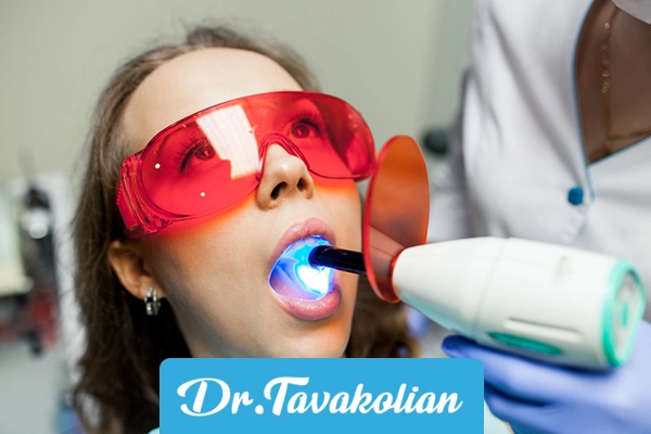 روش های انجام فلوراید تراپی در کودکان