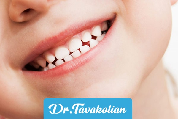 نحوه کشیدن دندان های کودکان