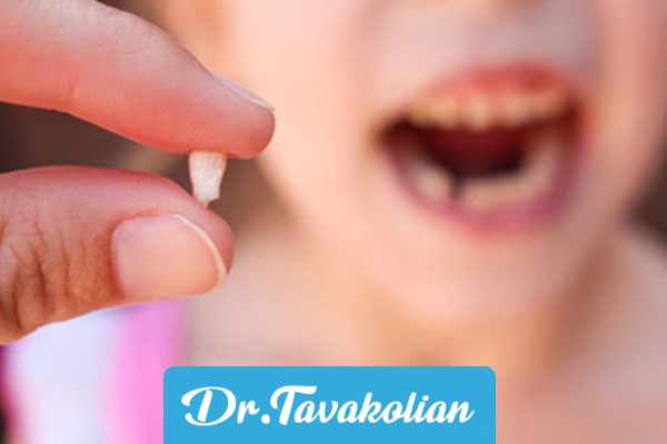 نحوه کشیدن دندان های کودکان