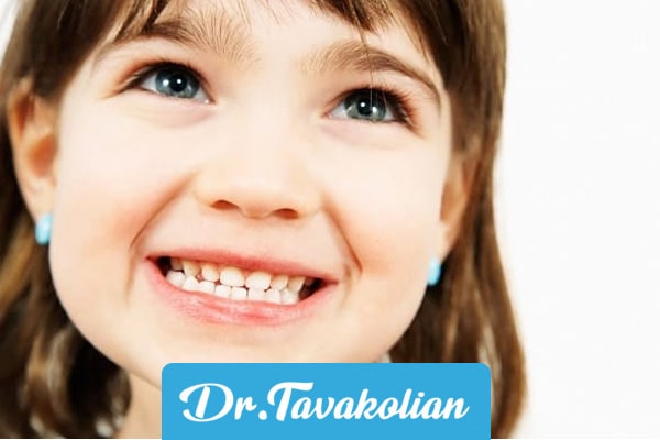 ارتودنسی درمان دندان قروچه کودکان