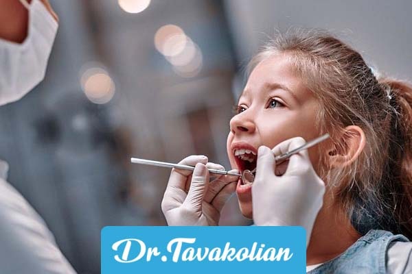 معرفی انواع روکش دندان کودکان