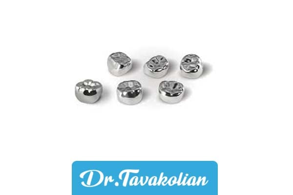 معرفی انواع روکش دندان کودکان