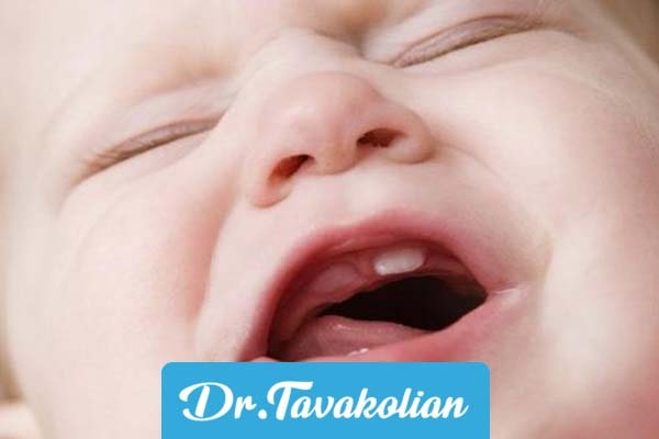 علت دیر دندان در آوردن برخی کودکان