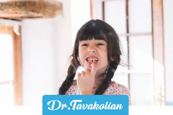 تعریف پر کردن دندان کودکان