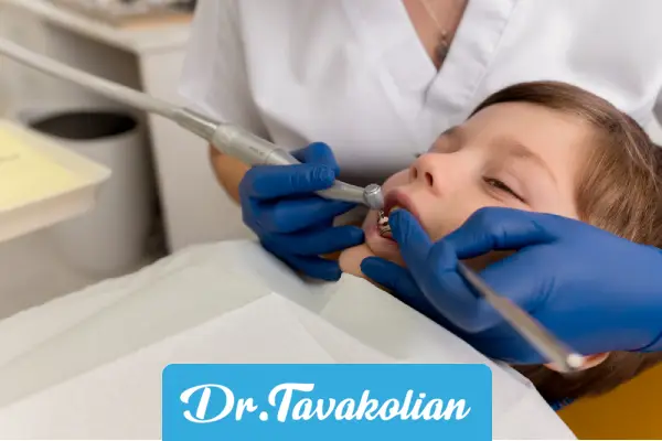 عصب کشی دندان کودکان