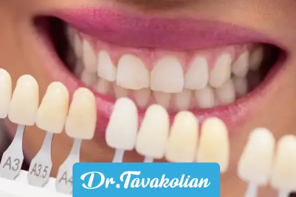 ایا میشود رنگ کامپوزیت را تغییر داد؟