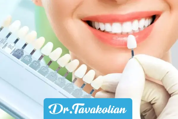ایا میشود رنگ کامپوزیت را تغییر داد؟