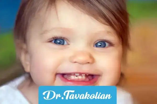 علائم پوسیدگی دندان