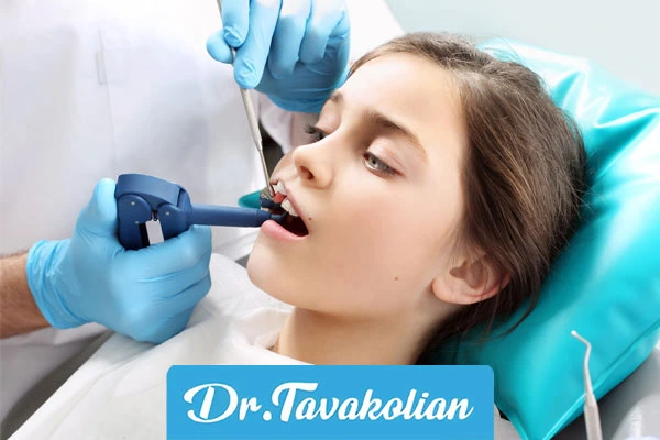 دندانپزشکی تخصصی کودکان برای فیشورسیلانت