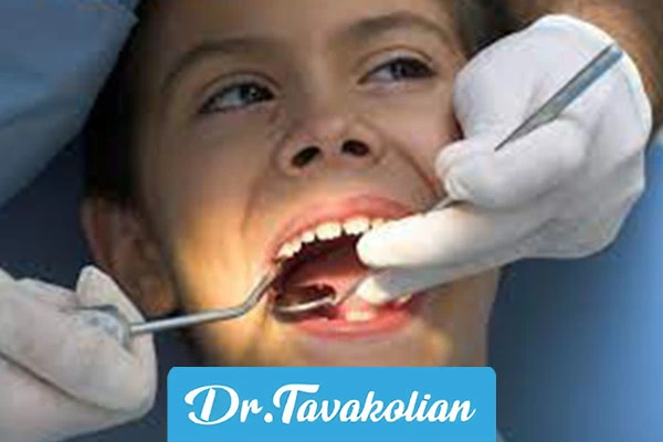 چک لیست انتقال دندانپزشکی