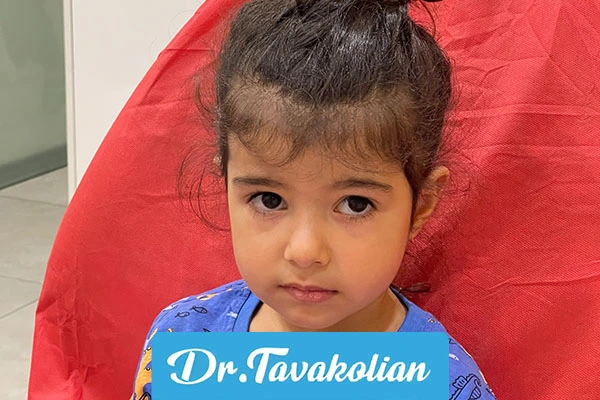 عاج دندان کودک